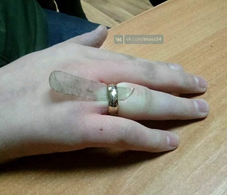 Спасатели сняли Кольцо Всевластия с пальца подростка