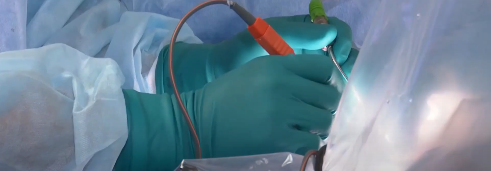 Попавшего под копыто лошади 2-летнего мальчика спасли новосибирские врачи