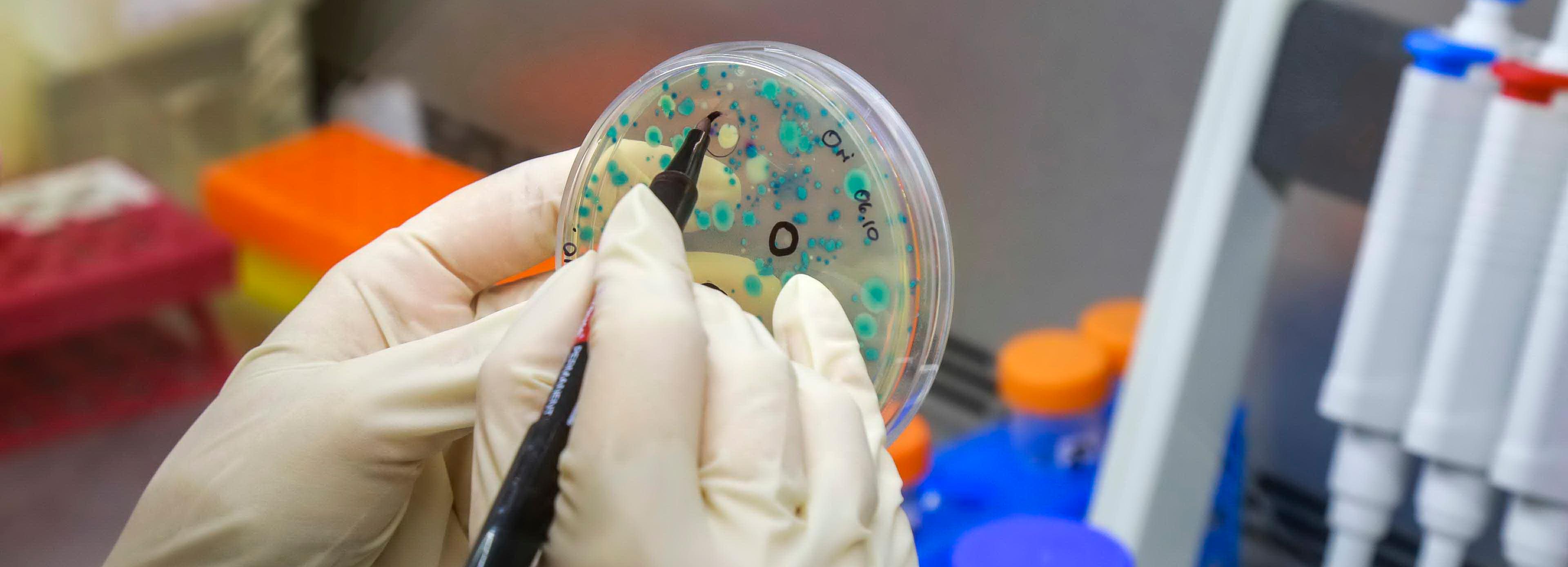 Первый российский препарат от оспы начнут производить в Новосибирске