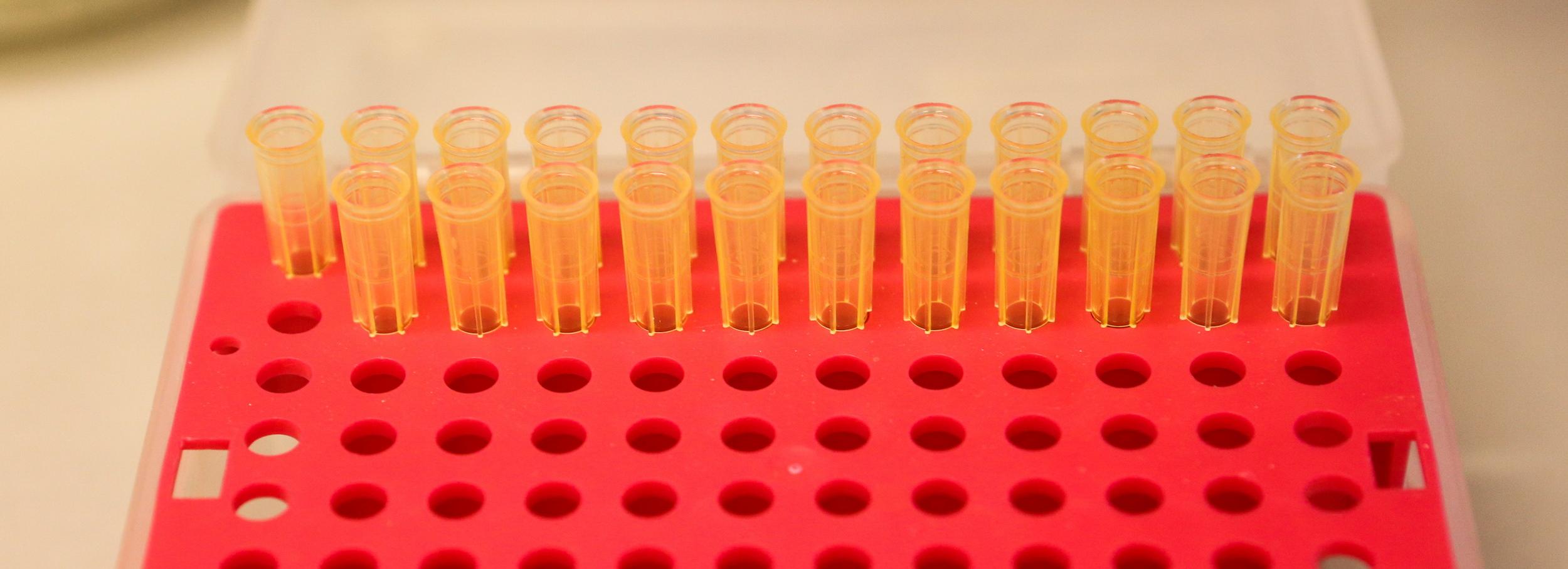 Новый микроорганизм нашли новосибирские учёные в Чёрном море