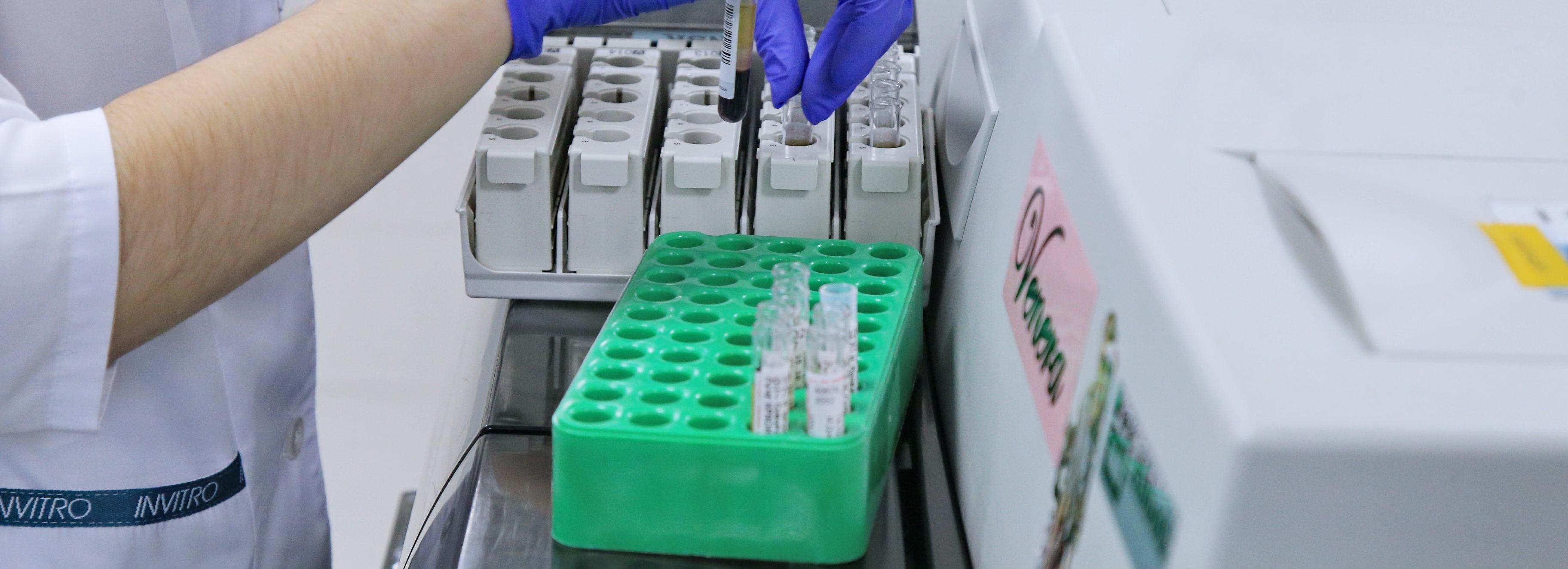 Станцию для изучения токсинов змей и белков бактериофагов откроют в СКИФе