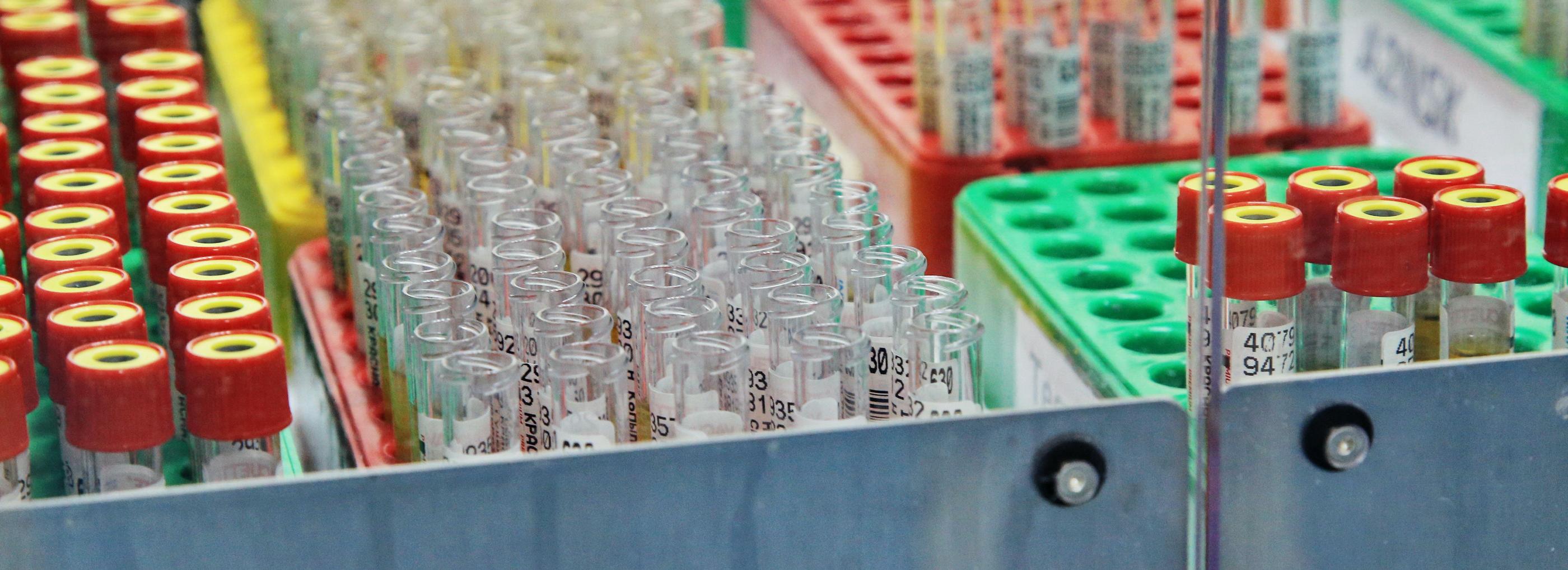 Протезы сосудов из пластика научился выращивать новосибирский студент