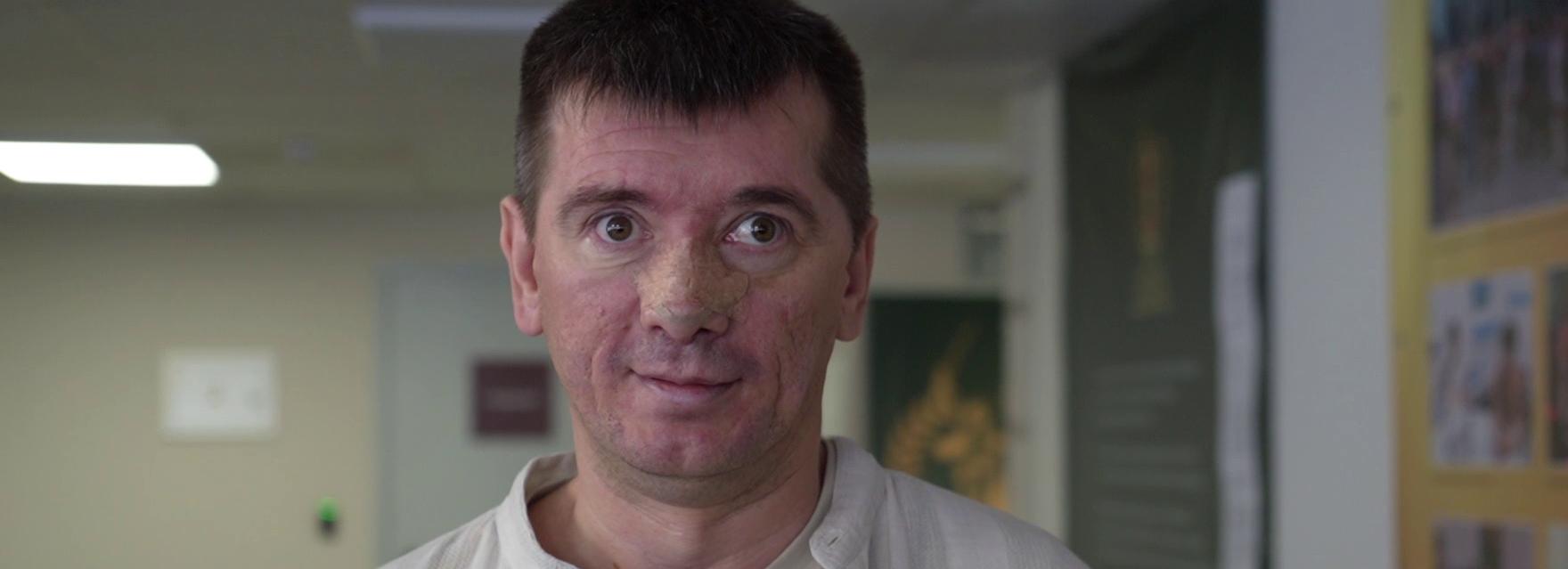 Женщина-волонтёр приютила потерявшего память бойца спецоперации