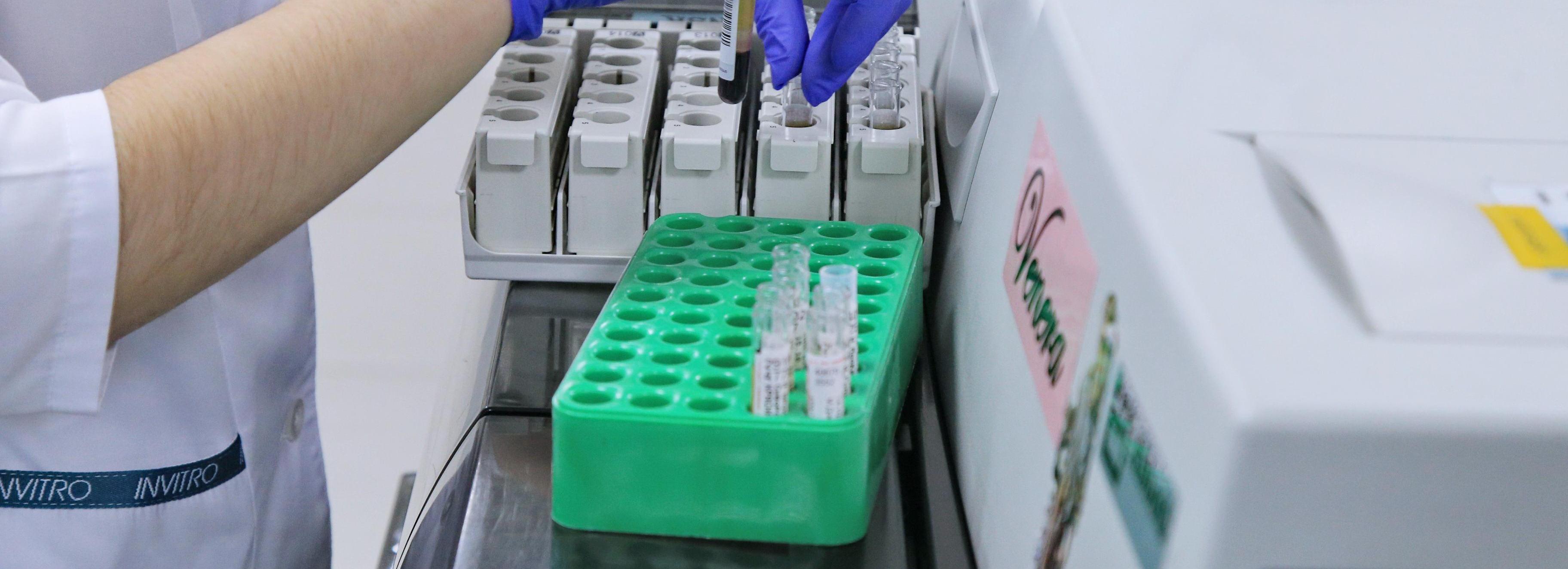 Жизнь скоропортящимся ягодам продлил биогель из НГТУ