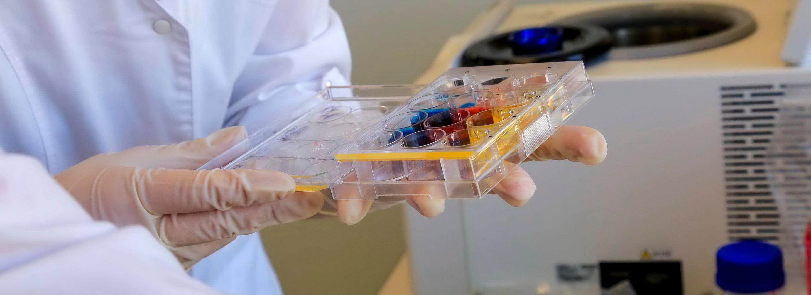 Способ эффективного лечения рака нашли учёные из Новосибирска