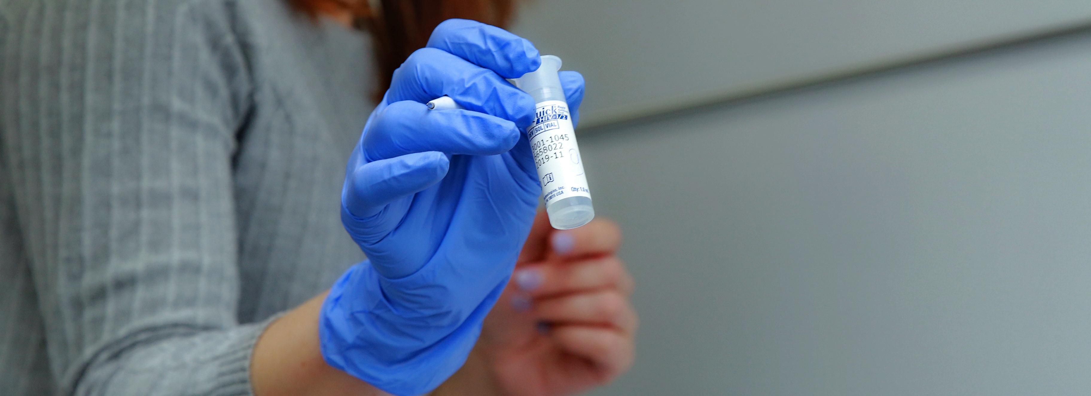 Заболеваемость ВИЧ в Сибири за пять лет снизилась вдвое