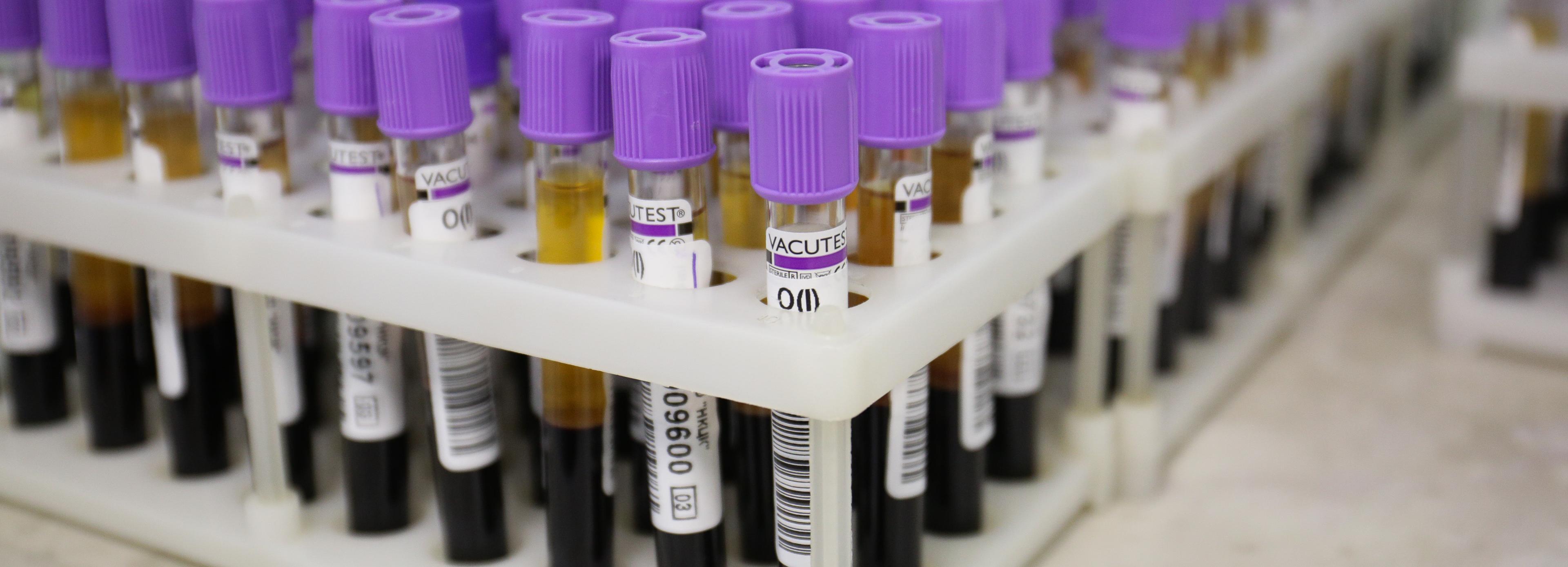 Новосибирцы смогут бесплатно сдать кровь на генетические заболевания