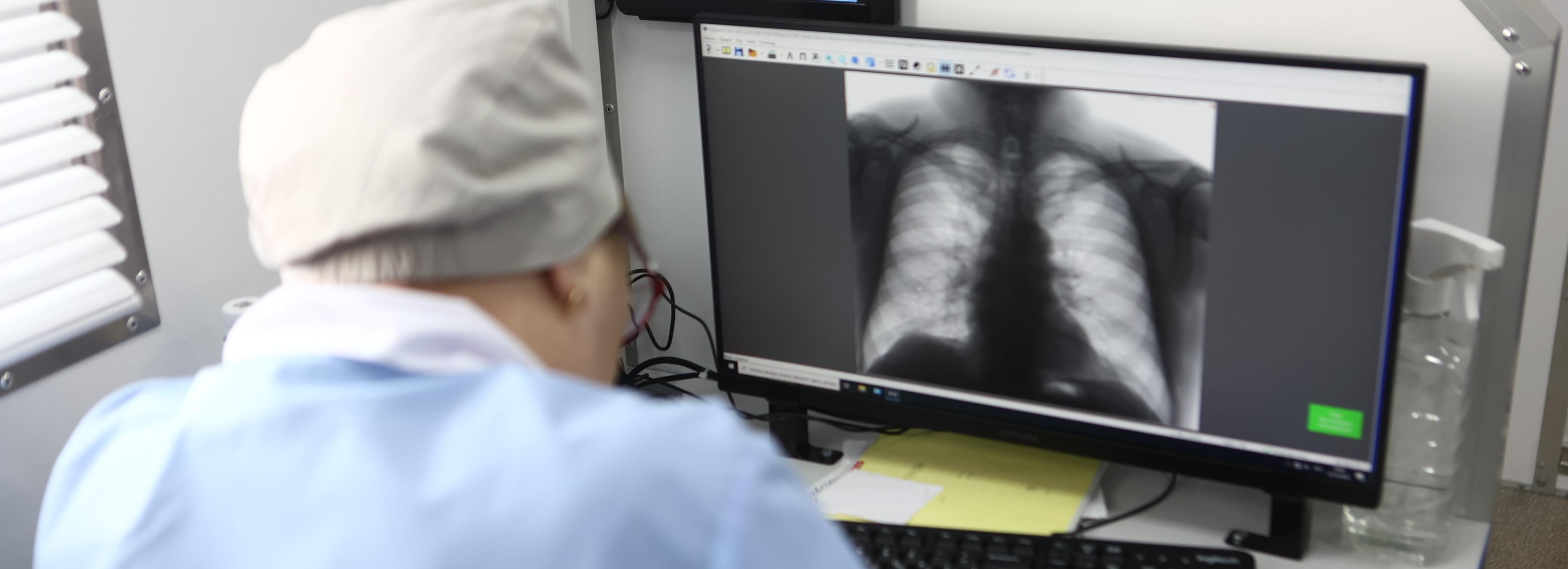 86 новосибирцев за год принудили лечиться от туберкулёза