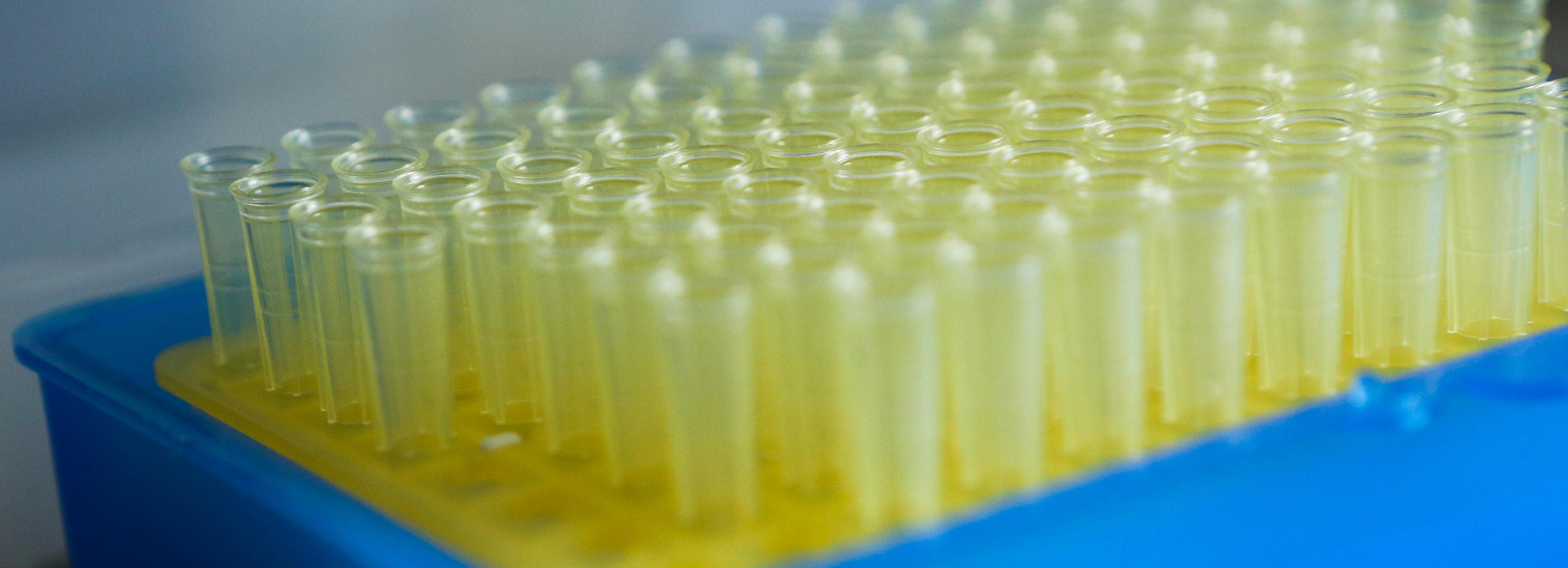 Студент НГУ выращивает чёрную и красную икру в пробирке