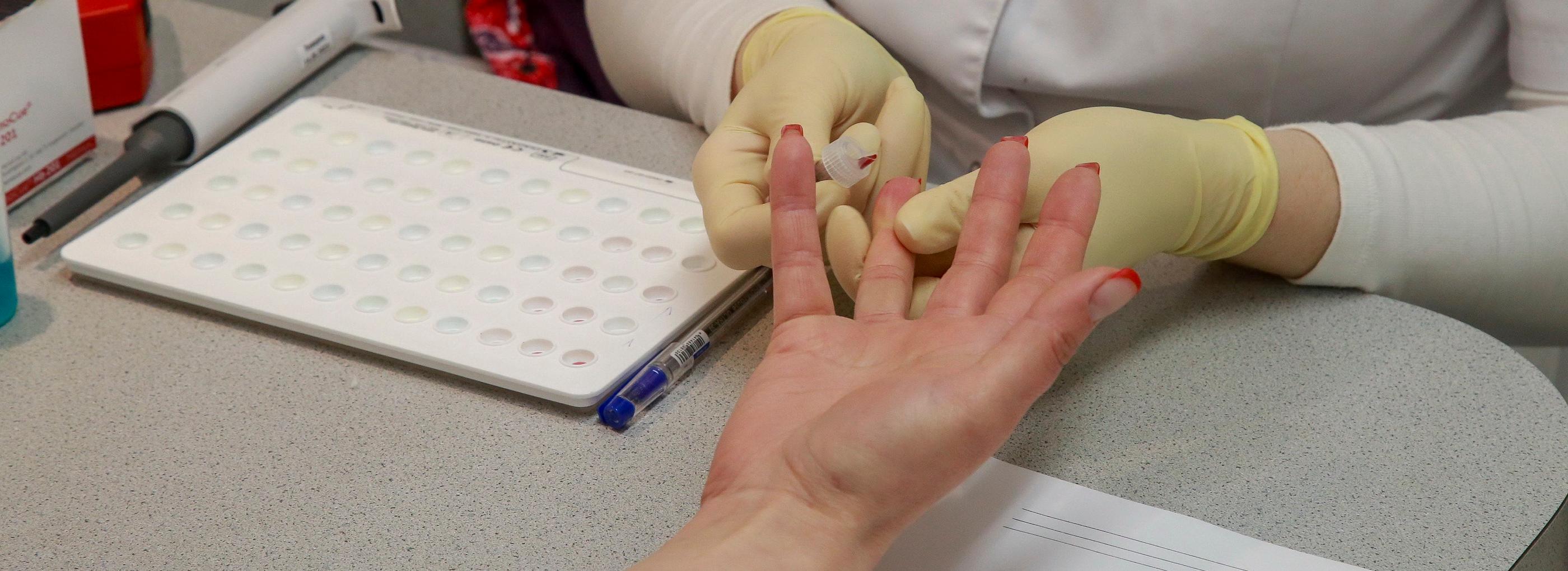 Экспресс-тест для определения группы крови создали в Новосибирске