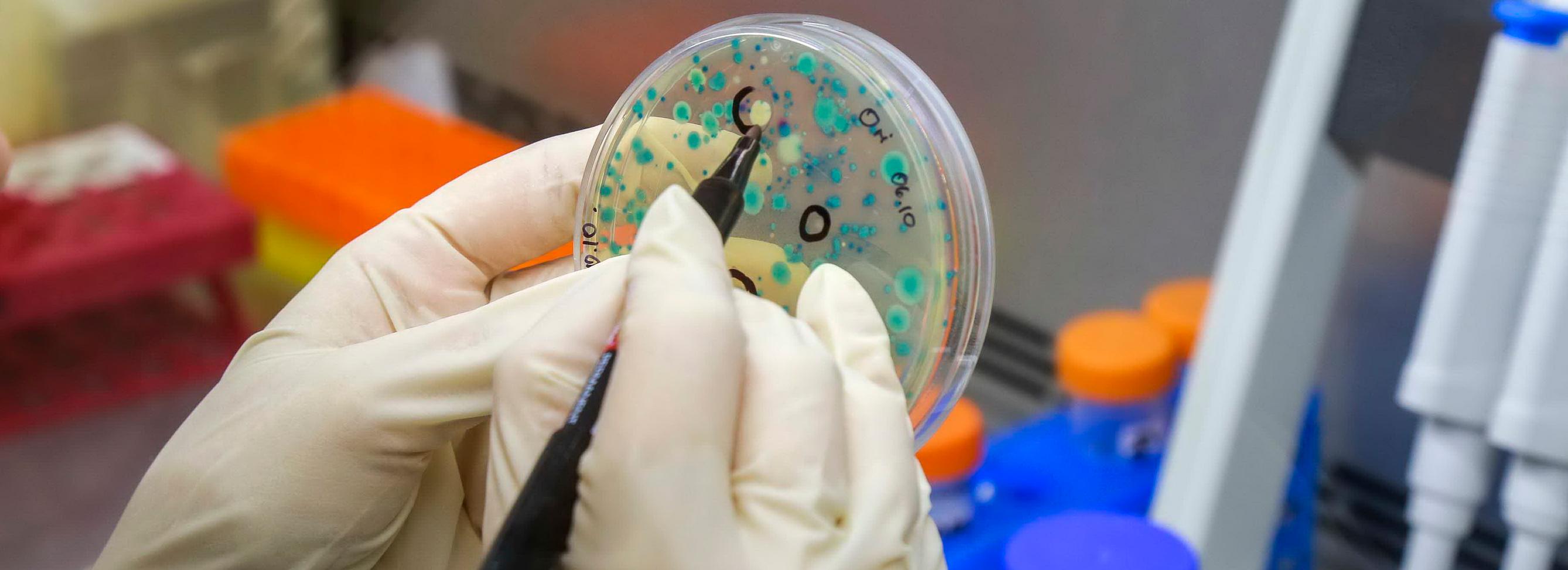 Роспотребнадзор рассказал туристам, как не заболеть лихорадкой чикунгунья