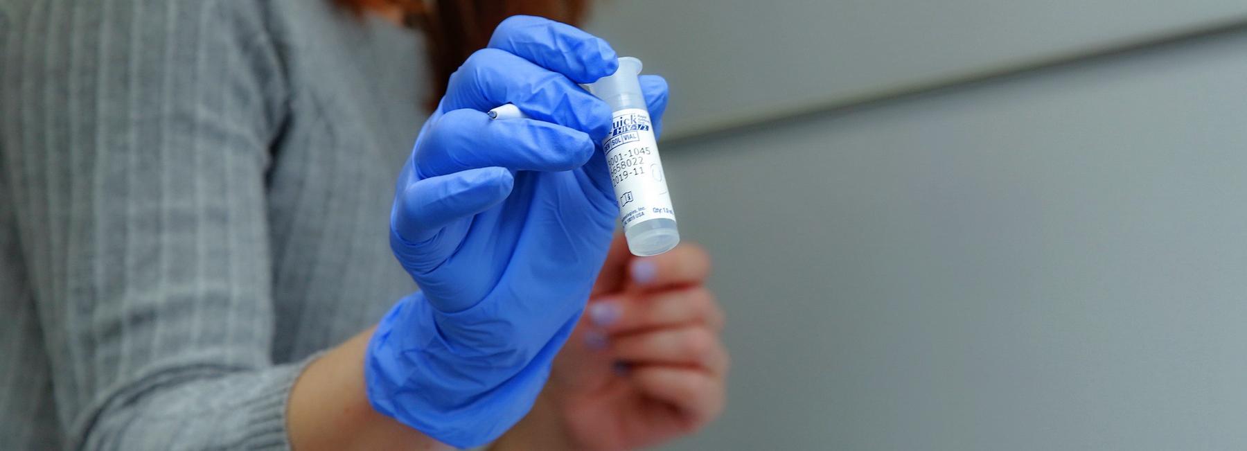 Где бесплатно сдать тест на ВИЧ-инфекцию в Новосибирске в марте