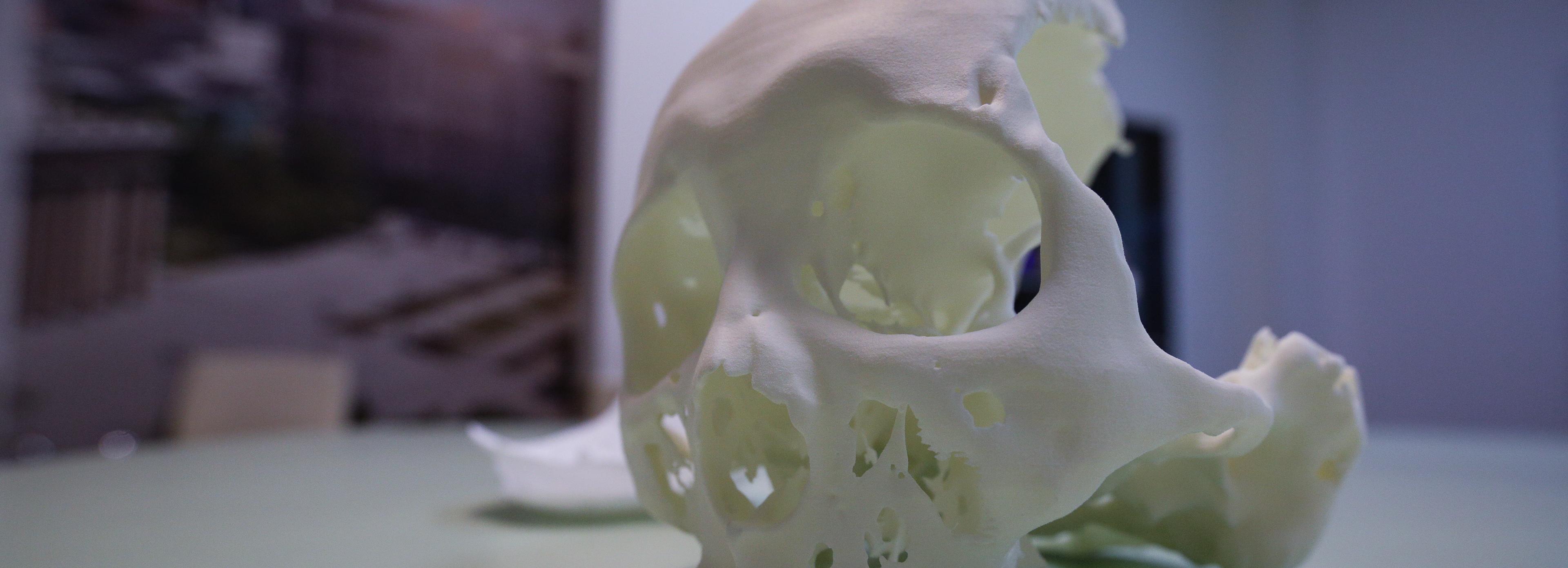 Имплантат для закрытия дефектов черепа разработали в НИИТО