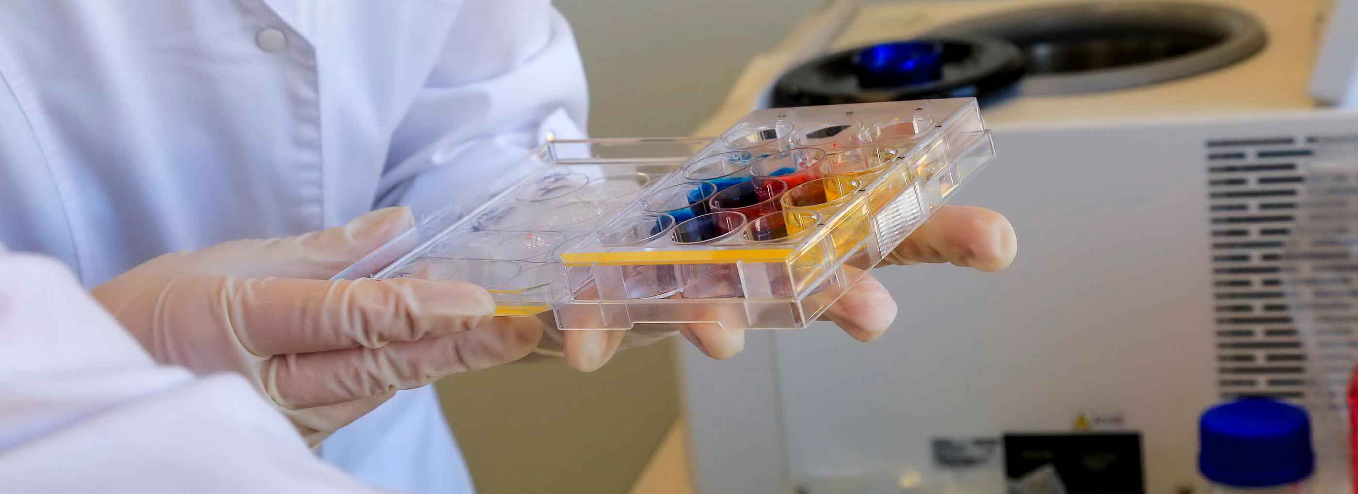 Средство против ВИЧ на основе чаги придумали под Новосибирском