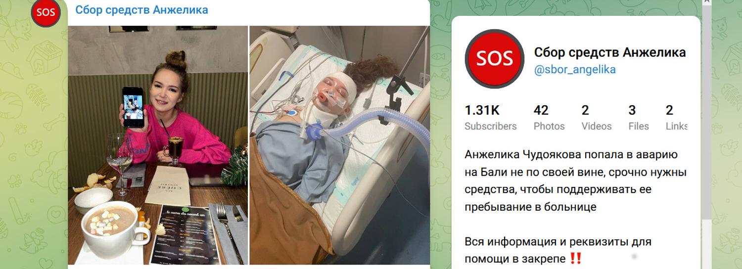 Попавшая в ДТП на Бали 22-летняя сибирячка умерла в больнице