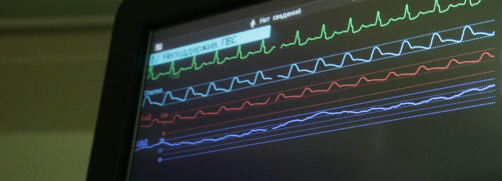 18-летний пациент попал с инфарктом в больницу Новосибирска