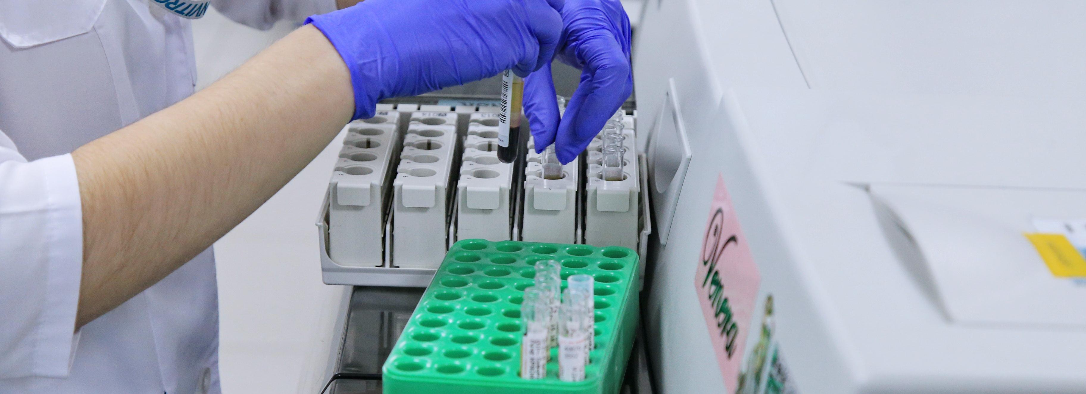 Что можно узнать о человеке по капле крови — ответ врача из Новосибирска