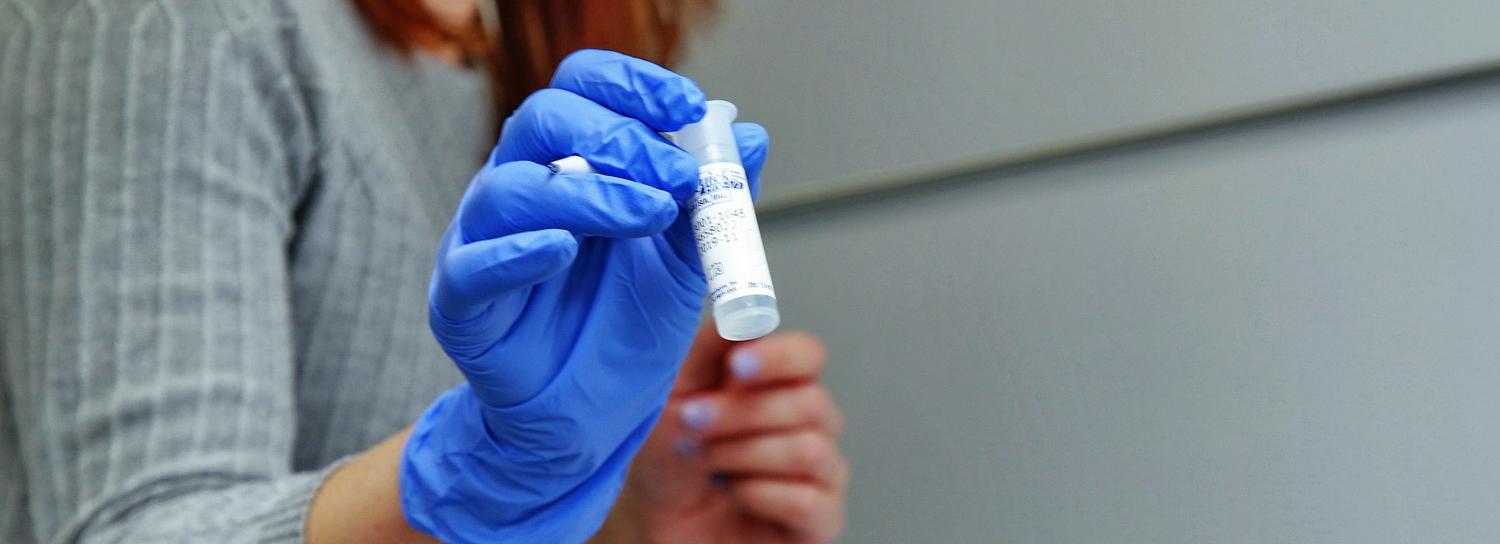 842 новосибирца с ВИЧ-инфекцией умерли в 2020 году