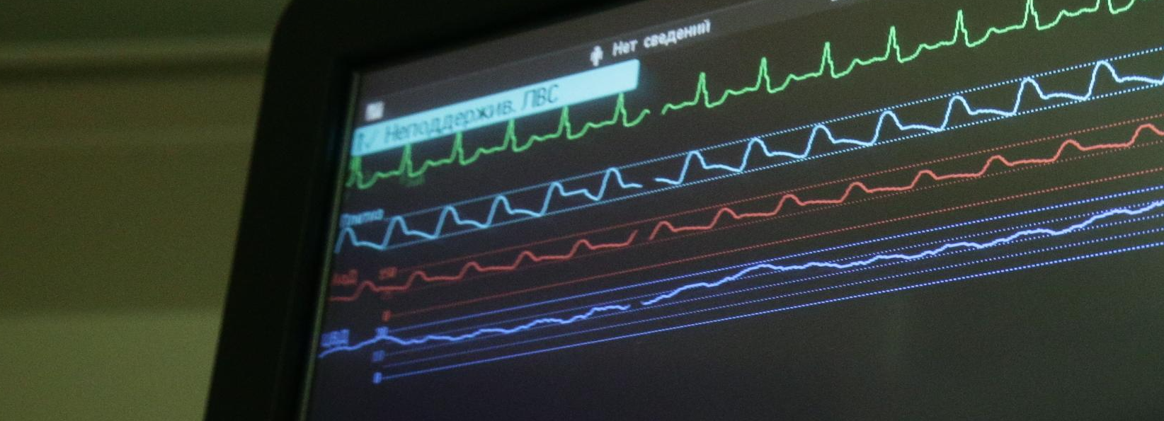Искусственное сердце из керамики создают новосибирские учёные