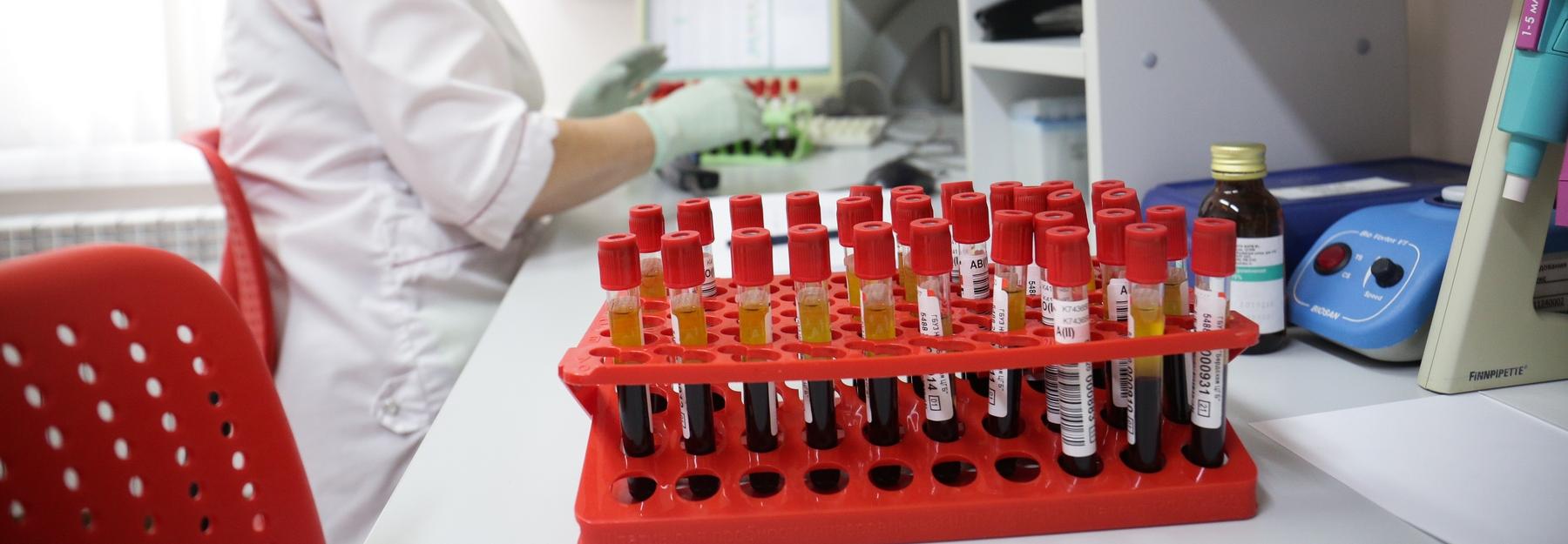 81 заболел и двое погибли из-за коронавируса: данные по Новосибирской области