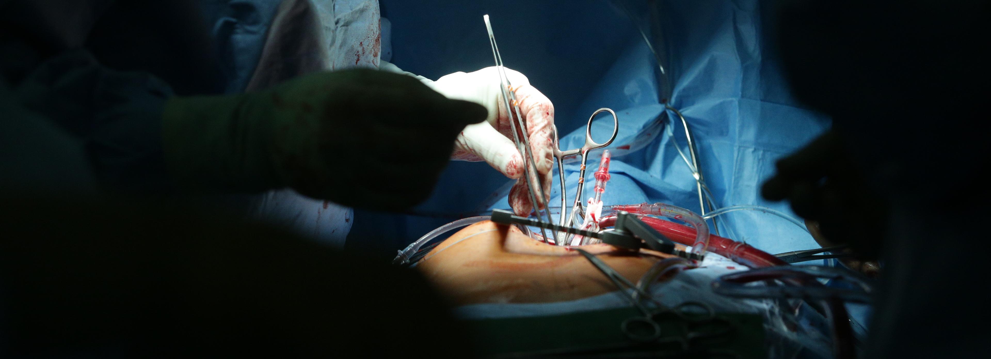 В Новосибирске сделали сложнейшую операцию женщине с синдромом Марфана