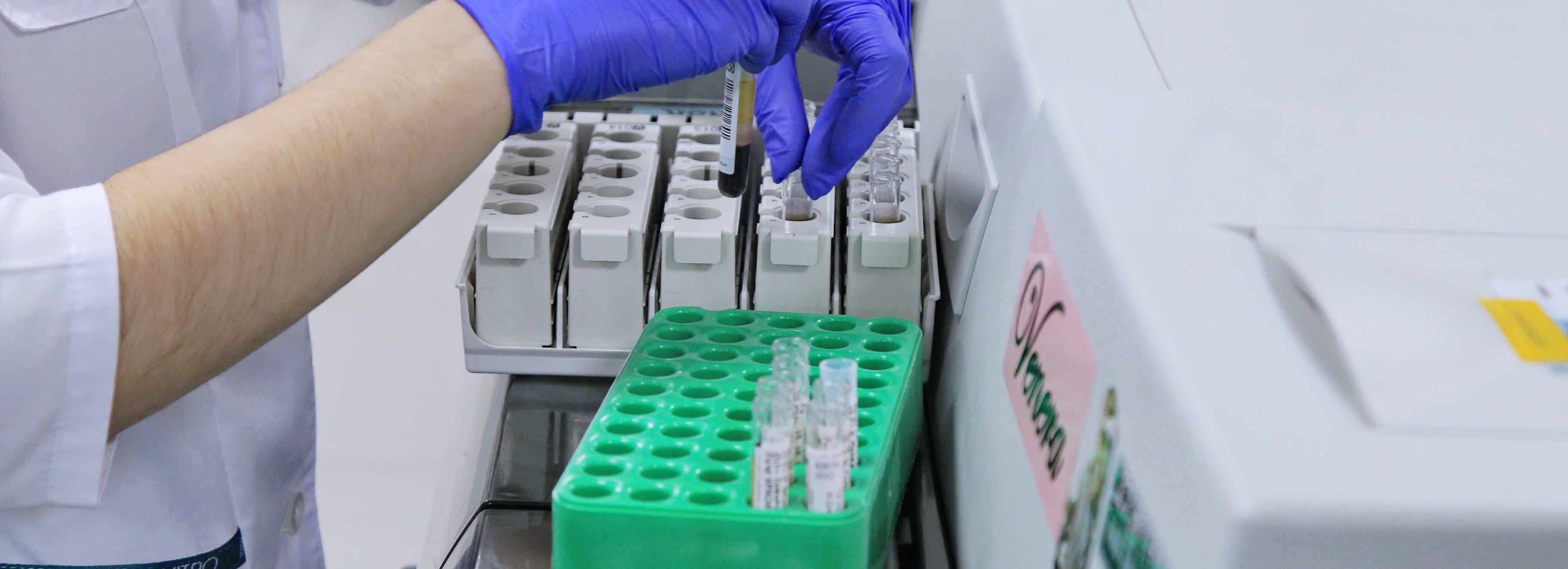 Новая ПЦР-лаборатория позволит делать 60 тестов на туберкулёз ежедневно