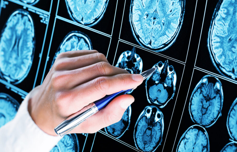 «Печально не ходить на каблуках»: как живут люди с рассеянным склерозом