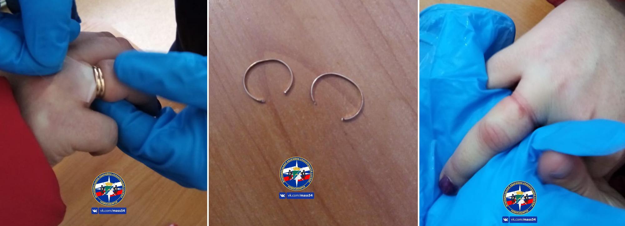 Спасатели сняли три кольца с двух сибирячек в новогодние праздники