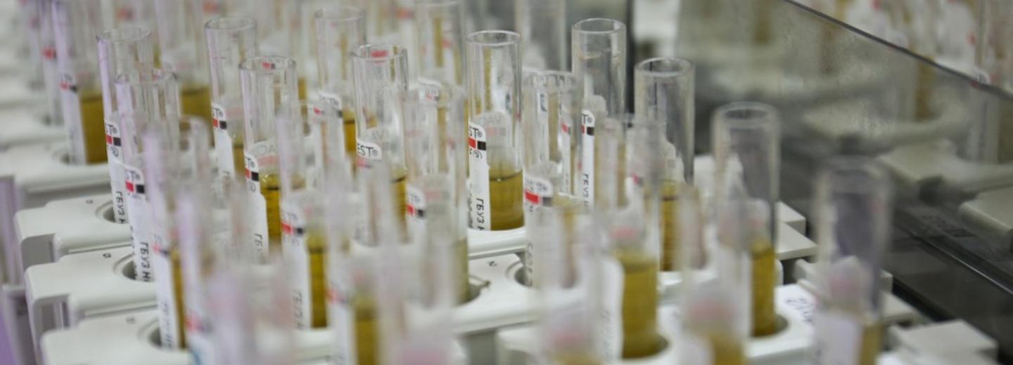 От коронавируса в Новосибирской области умерли уже 30 человек