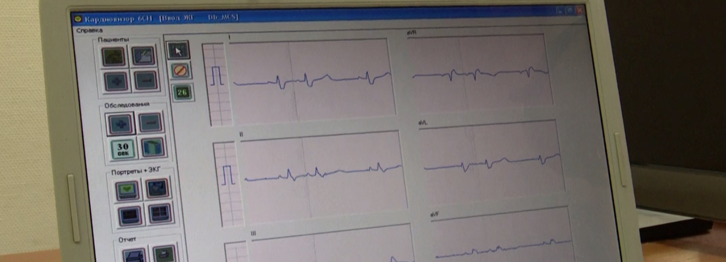 Новосибирцы старше 55 лет бесплатно проверили сердце на кардиовизоре