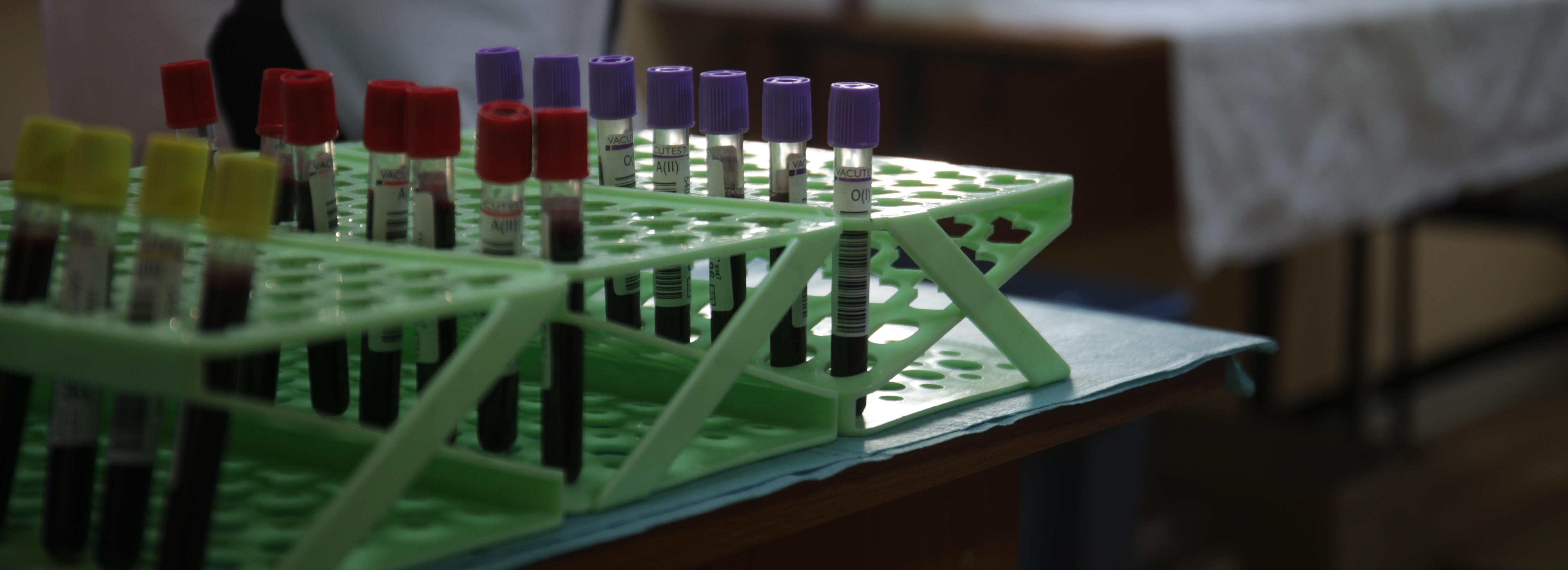 Почти 35 тысяч литров донорской крови собрали за 2024 год в Новосибирске