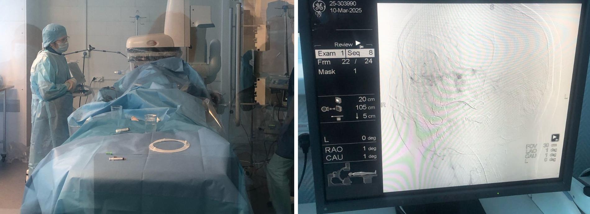 Ангиографию впервые выполнили на новой установке в 34-й больнице