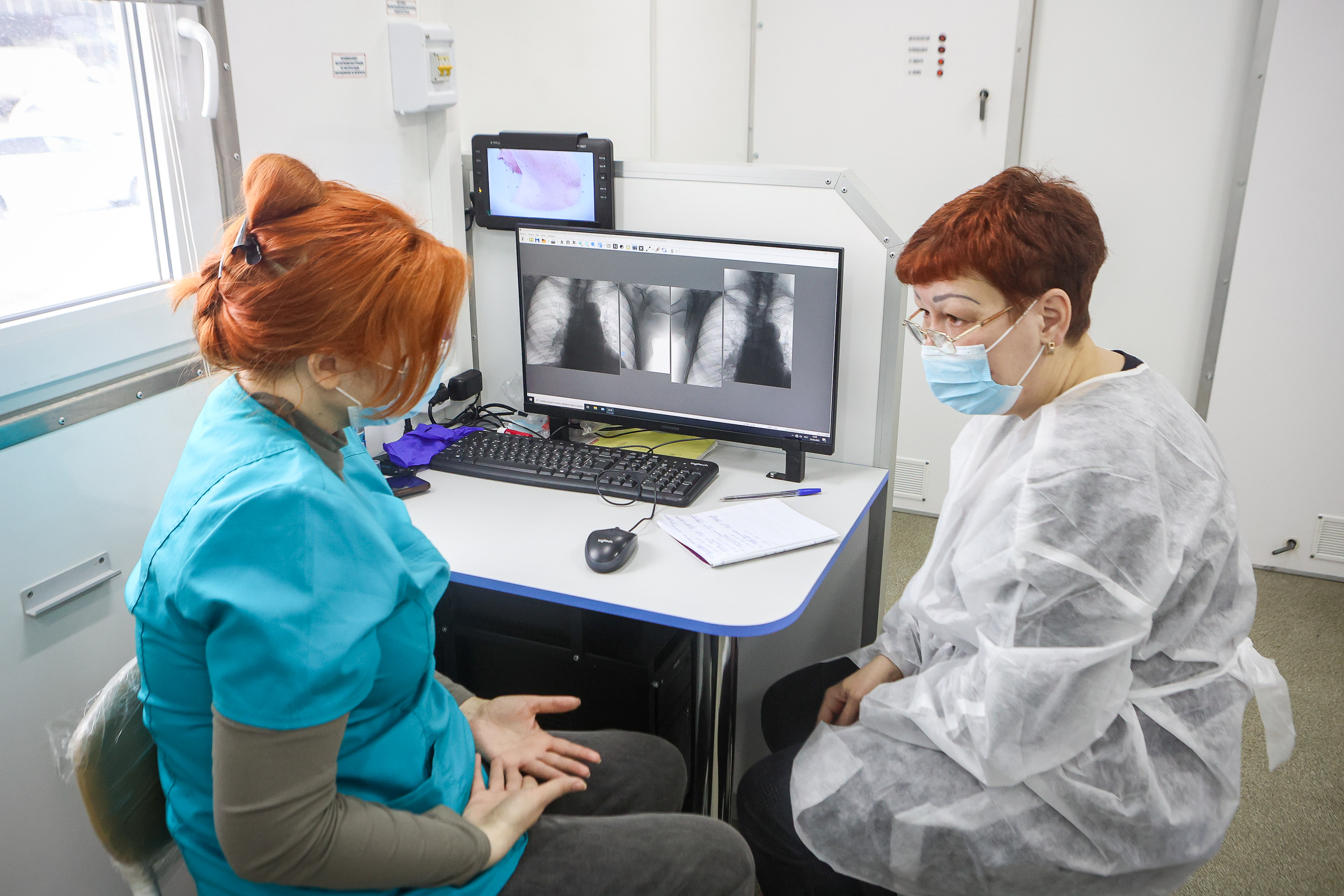 Искусственный интеллект помогает лечить новосибирцев от туберкулёза