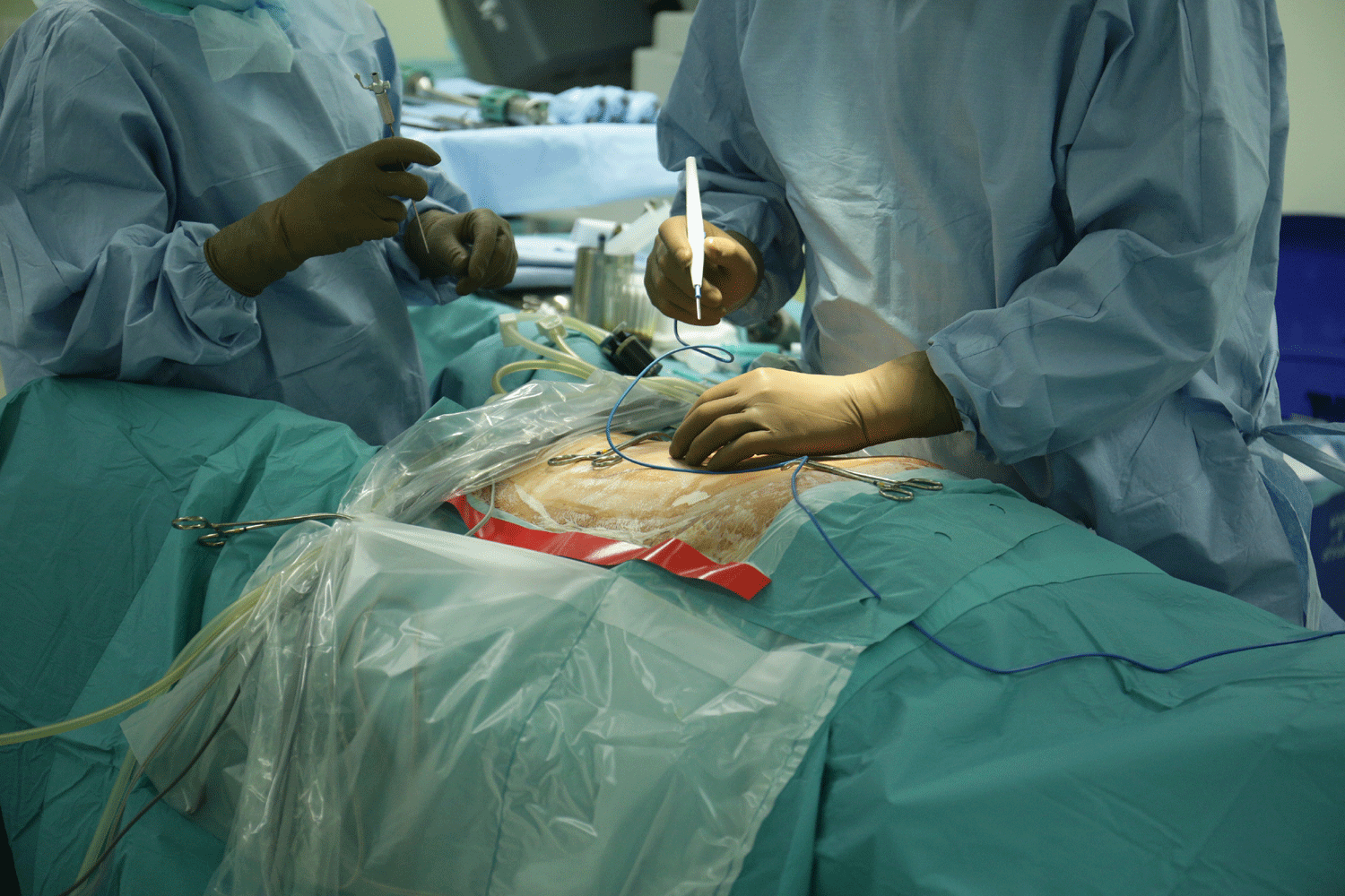 Пациента с донорским сердцем излечили от рака почки в Новосибирске