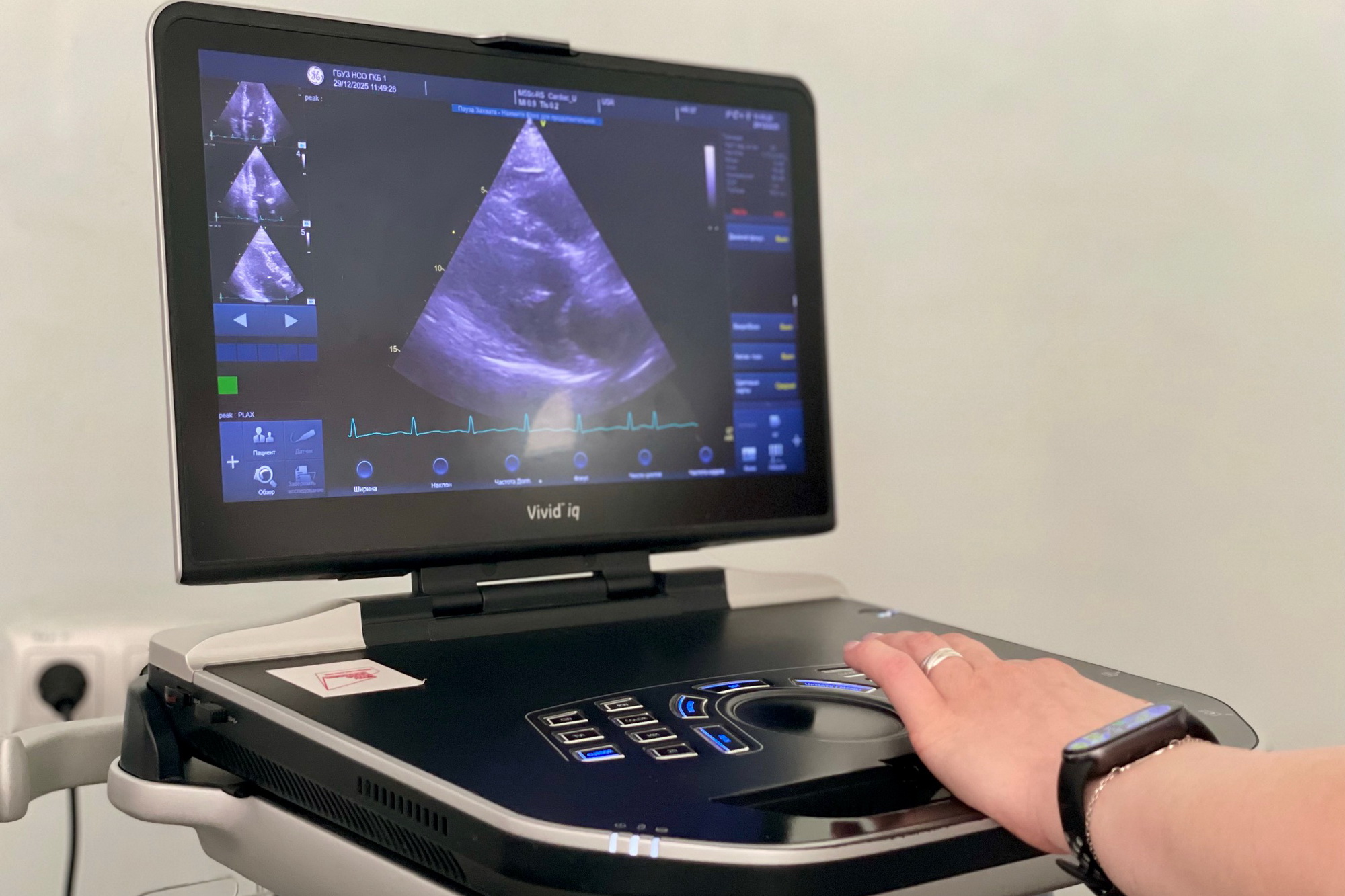 Новое оборудование поможет выявлять у новосибирцев ишемию на ранней стадии