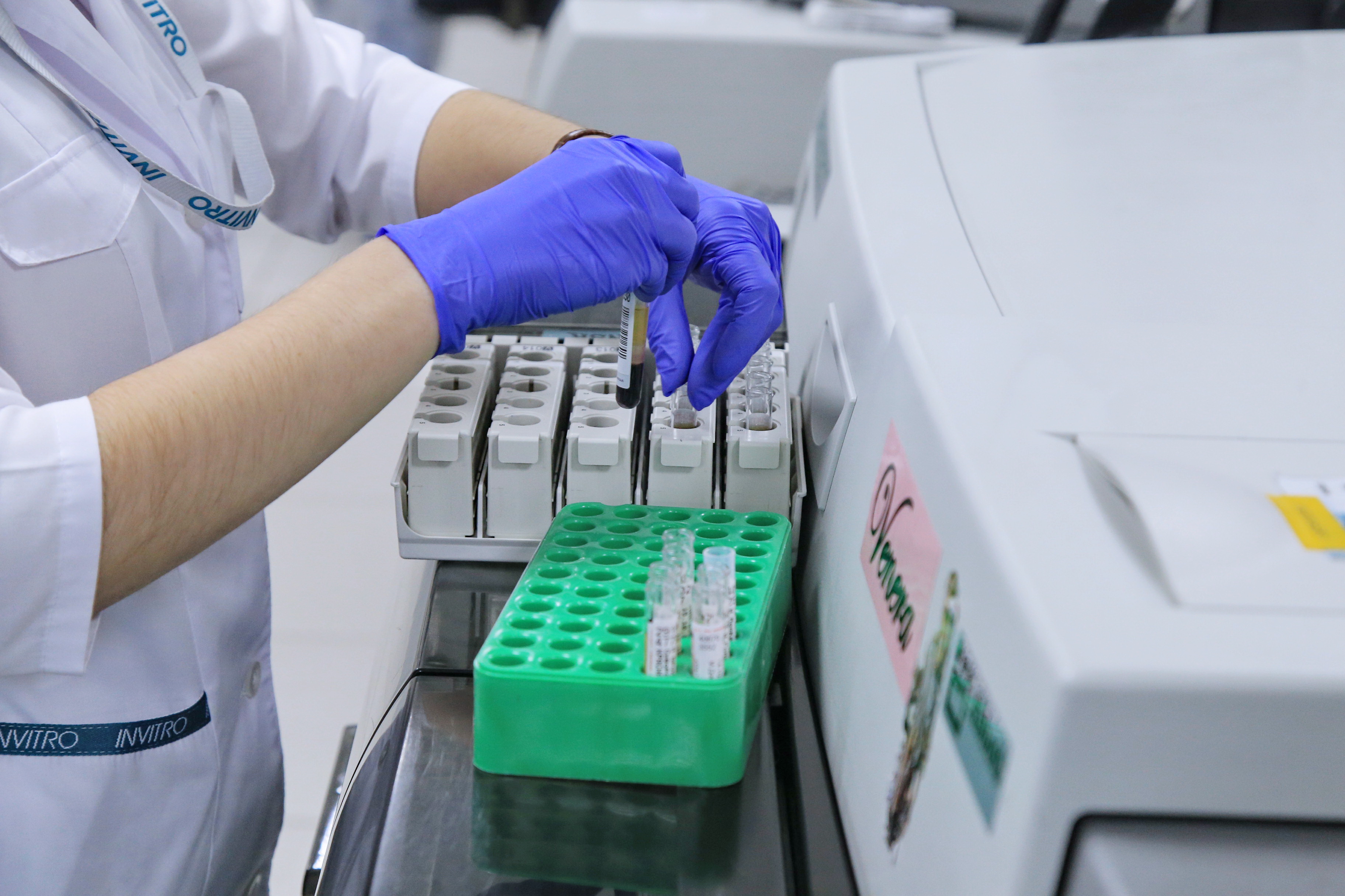 Новосибирские учёные создали доступный анализатор крови