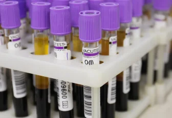 Новосибирцы смогут бесплатно сдать кровь на генетические заболевания