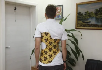 Почему возникает сколиоз — рассказал ортопед из Новосибирска 