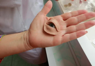 Протезирование глаз внесли в губернаторский сертификат в Новосибирске