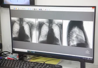 Передвижной флюорограф приедет на привокзальную площадь в Новосибирске