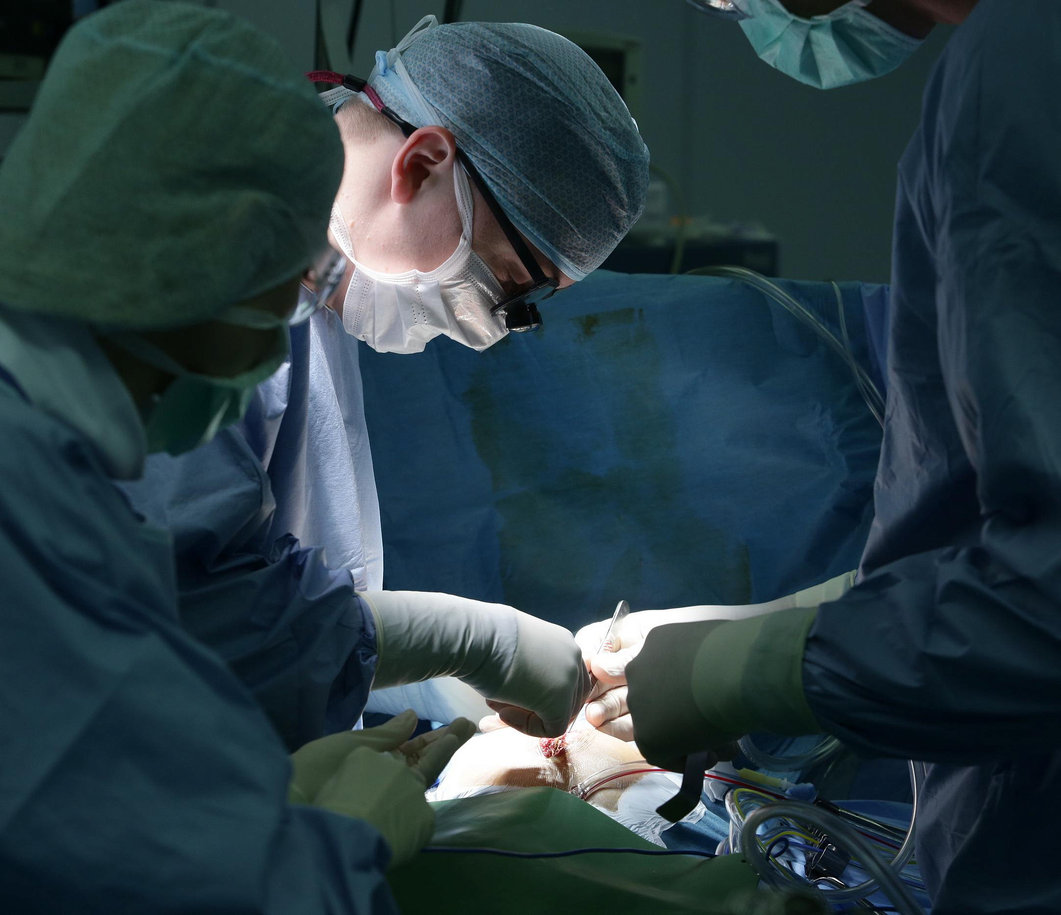 Новосибирские хирурги спасли пациента с помощью уникального протеза аорты