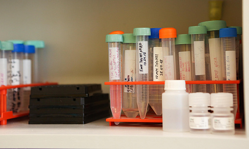 Уникальный препарат от сахарного диабета разрабатывают новосибирцы