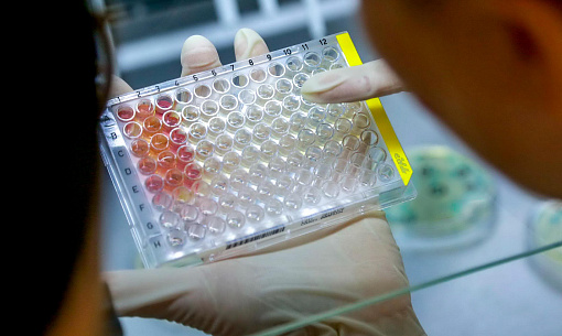 Как усовершенствовать лекарства от оспы — придумали в Новосибирске