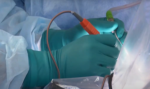 Устройство для уничтожения рака микроволнами создают в Новосибирске