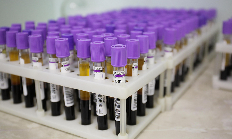 Новосибирцы смогут бесплатно сдать кровь на генетические заболевания