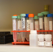 Уникальный препарат от сахарного диабета разрабатывают новосибирцы