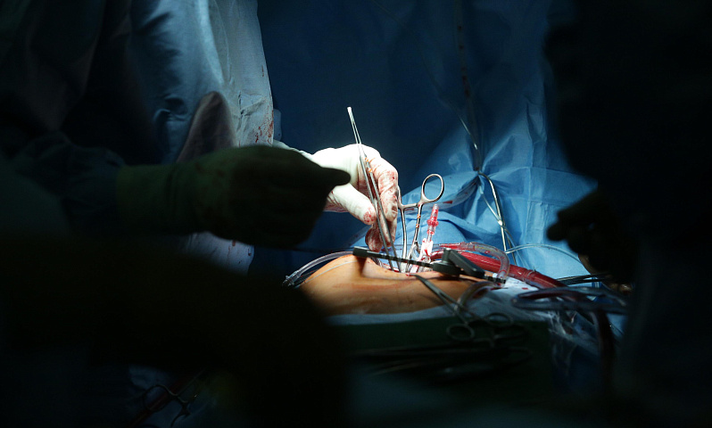 В Новосибирске сделали сложнейшую операцию женщине с синдромом Марфана