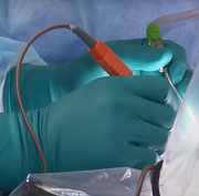 Устройство для уничтожения рака микроволнами создают в Новосибирске