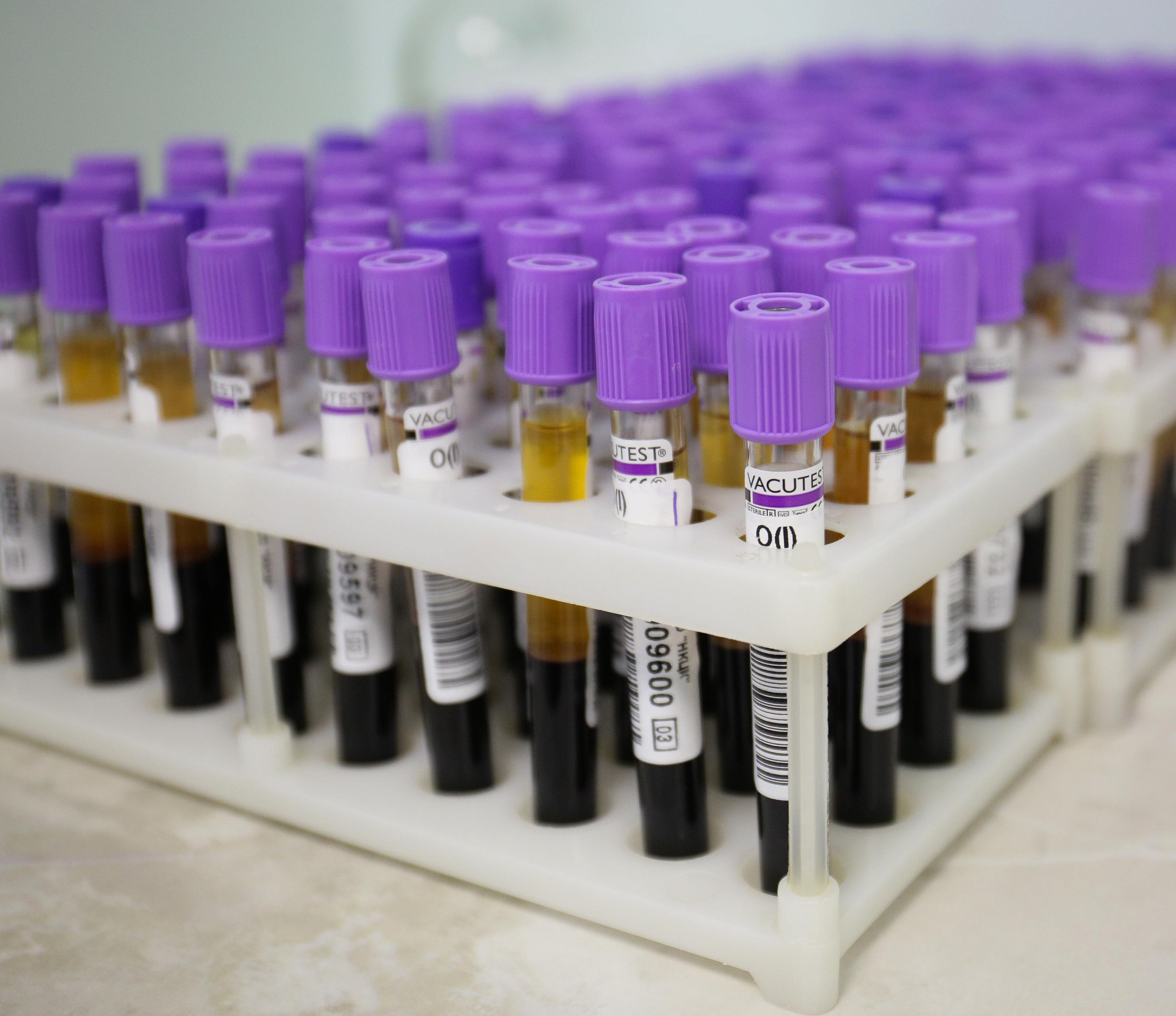 Новосибирцы смогут бесплатно сдать кровь на генетические заболевания