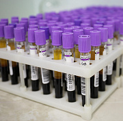 Новосибирцы смогут бесплатно сдать кровь на генетические заболевания